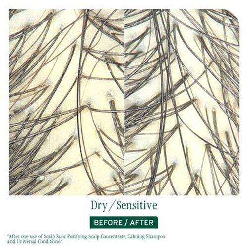 Scalp Sync Purifying Scalp Concentrate - Biolage Renovation NZ | L'Or&eacute;al Partner Shop